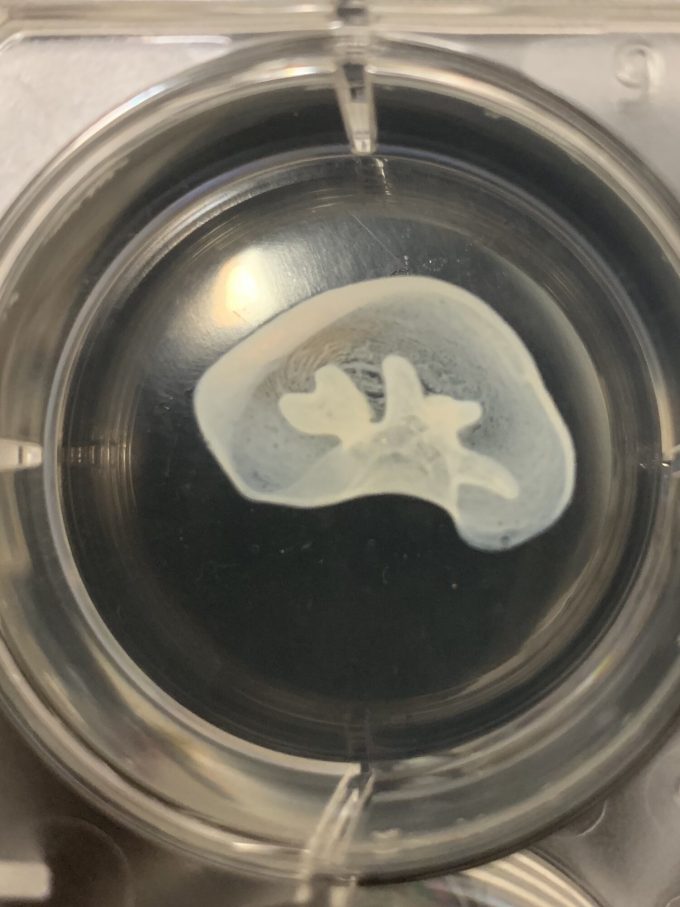 3d printed kidney