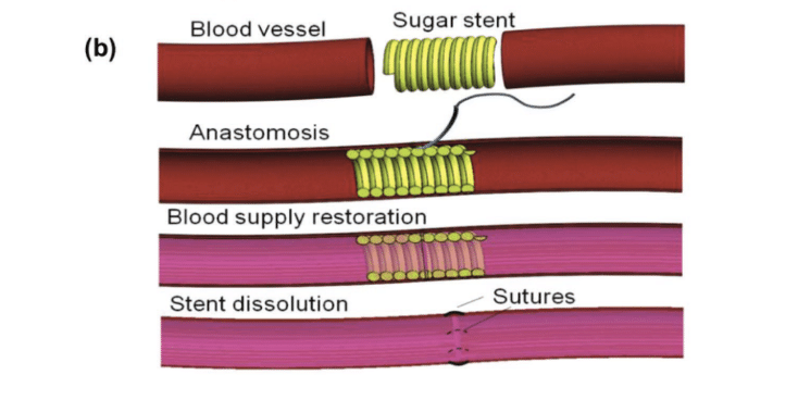 allevi 2 3d bioprinter fabricates sugar stents to aid in surgical procedure