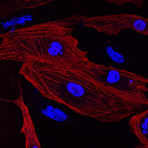 bioprint cardiac tissue on Allevi