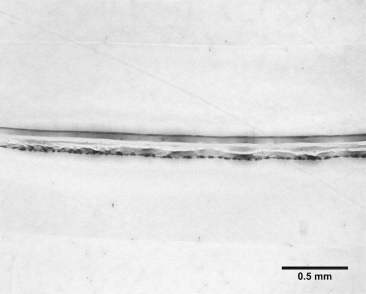 Bioprinted Alginate with the FRESH method is able to achieve a resolution of 0.15 +/- 0.03