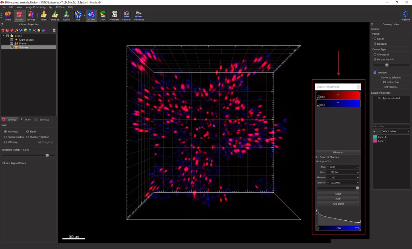 Live/Dead Assay Quantification Using Imaris