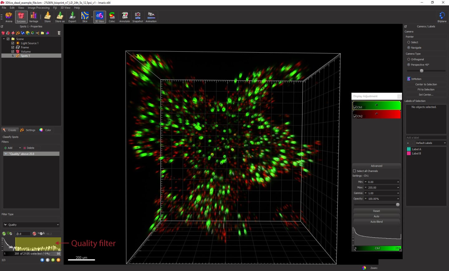 Live/Dead Assay Quantification Using Imaris