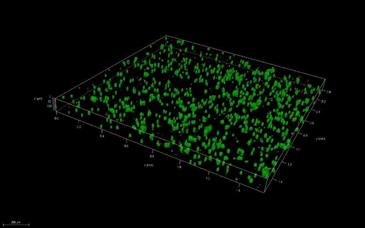 Figure 4: Confocal image of bioprinted PEGDA (top) and pipetted PEGDA (bottom) after 7 days of culture. Images taken at 10x magnification.