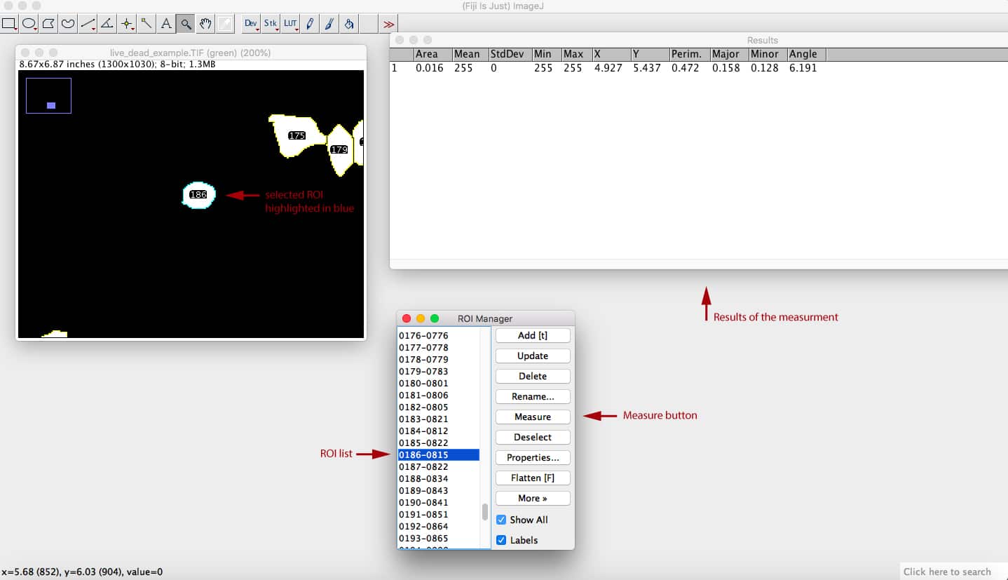 Live/Dead assay quantification using Fiji