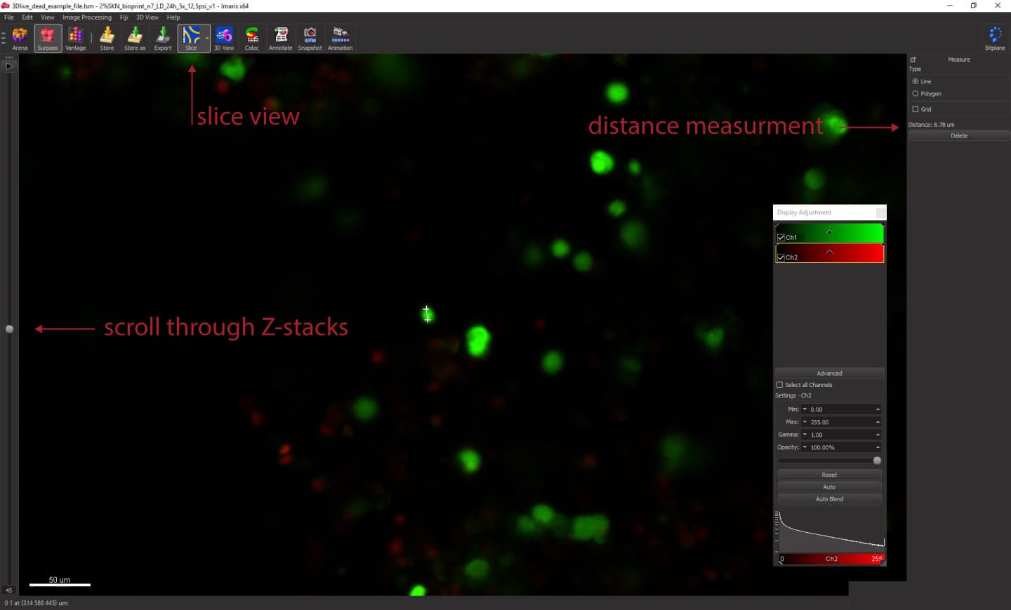 Live/Dead Assay Quantification Using Imaris