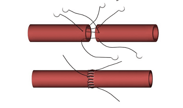 suturing blood vessels