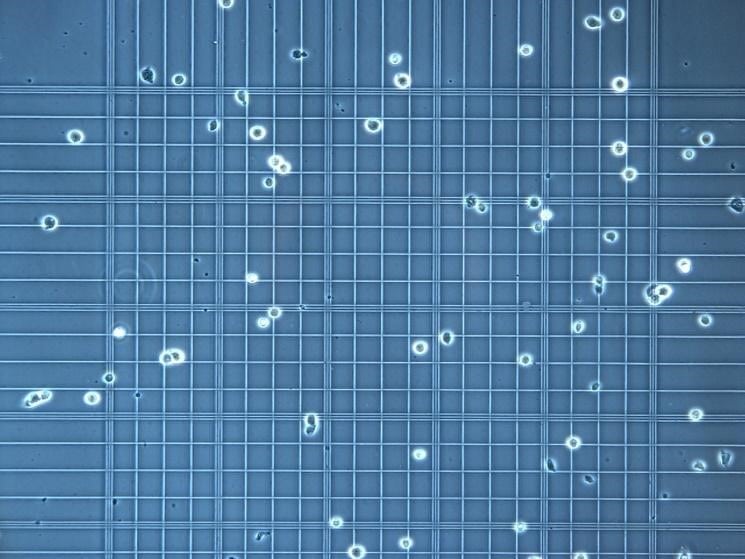 Cell Counting Using Hemocytometer : Automated Cell Counting: Selecting the Appropriate System ... / A known volume of cell culture is counted using a haemocytometer and the total number of cells is calculated.