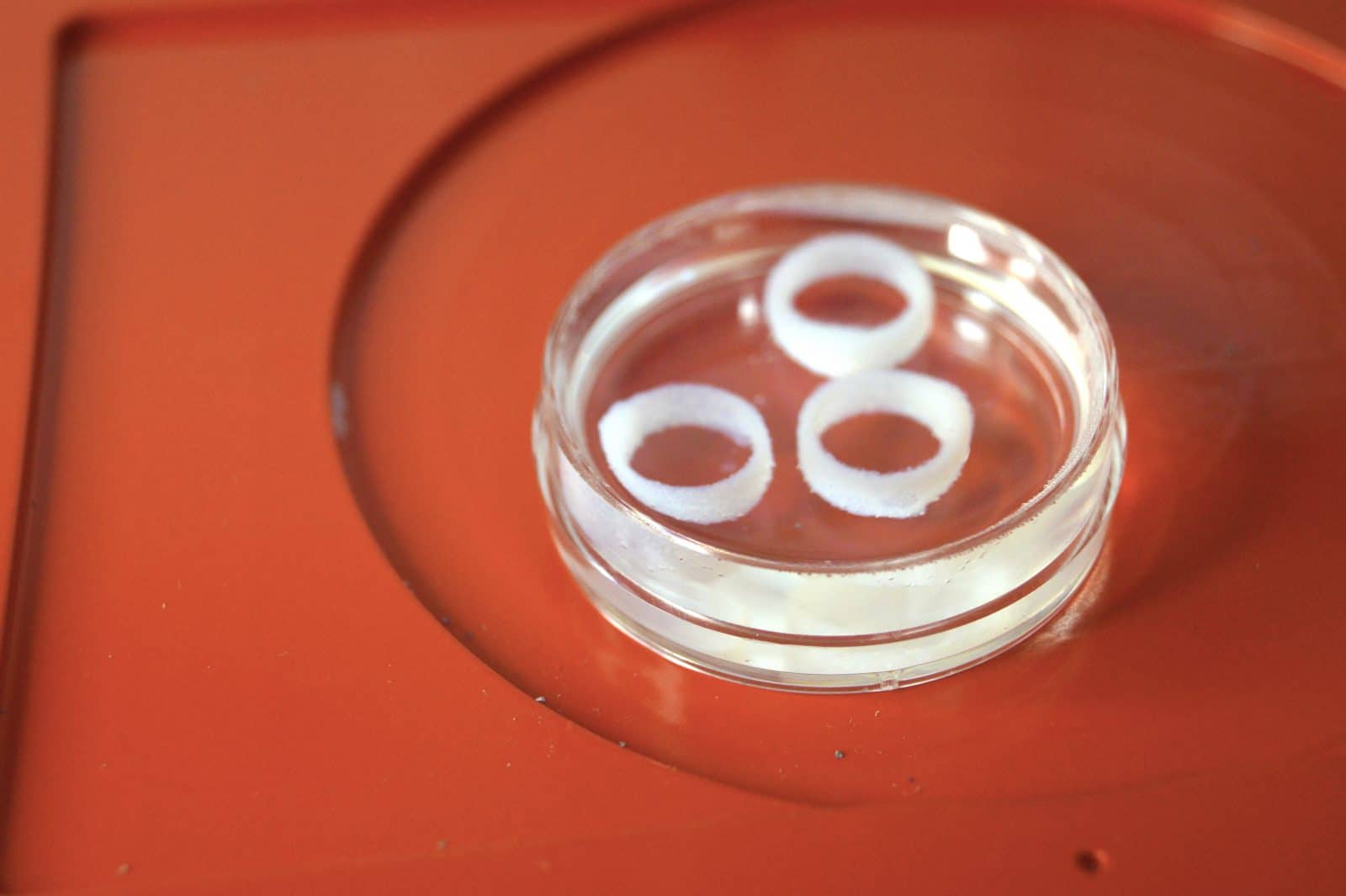 collagen and FRESH bioprinting