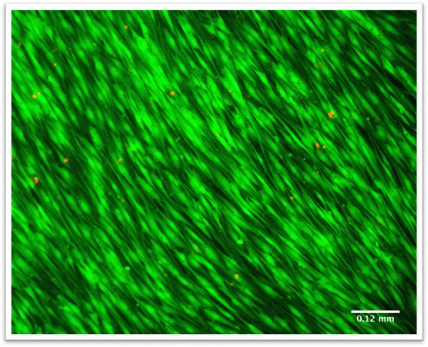 how to choose cell density for bioprinting