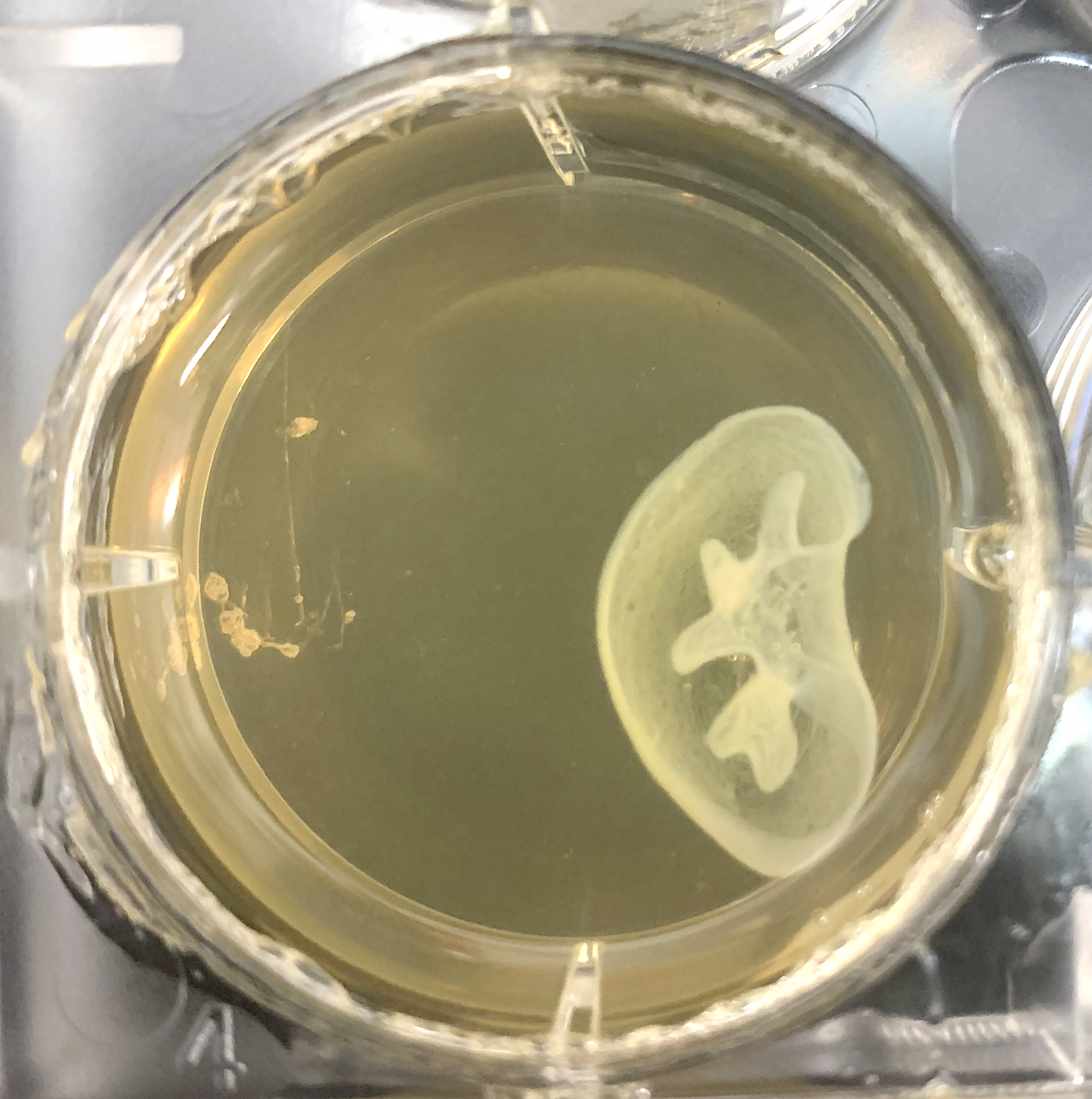 kidney bioprinted structure using FRESH and lifesupport