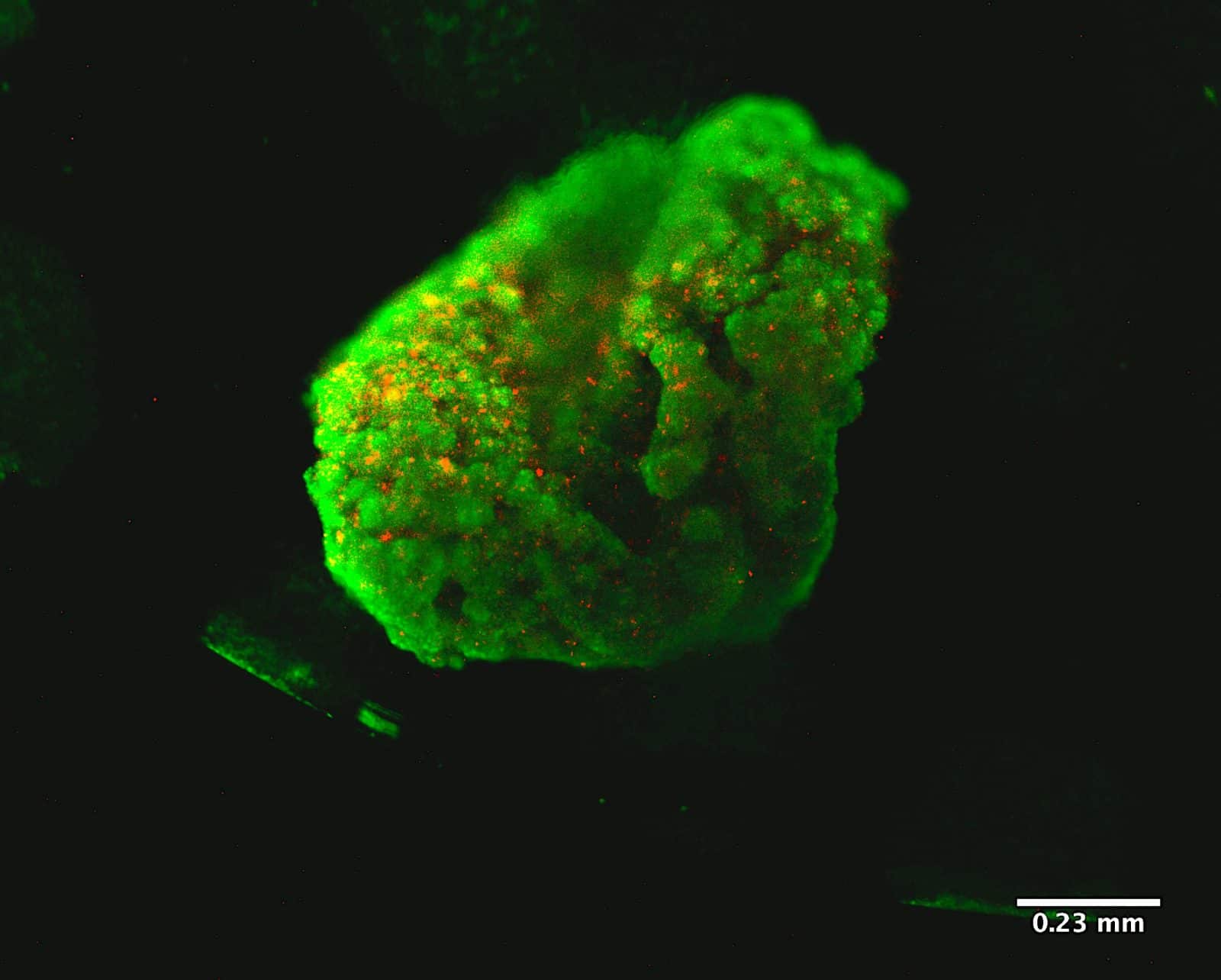 matrigel organoid